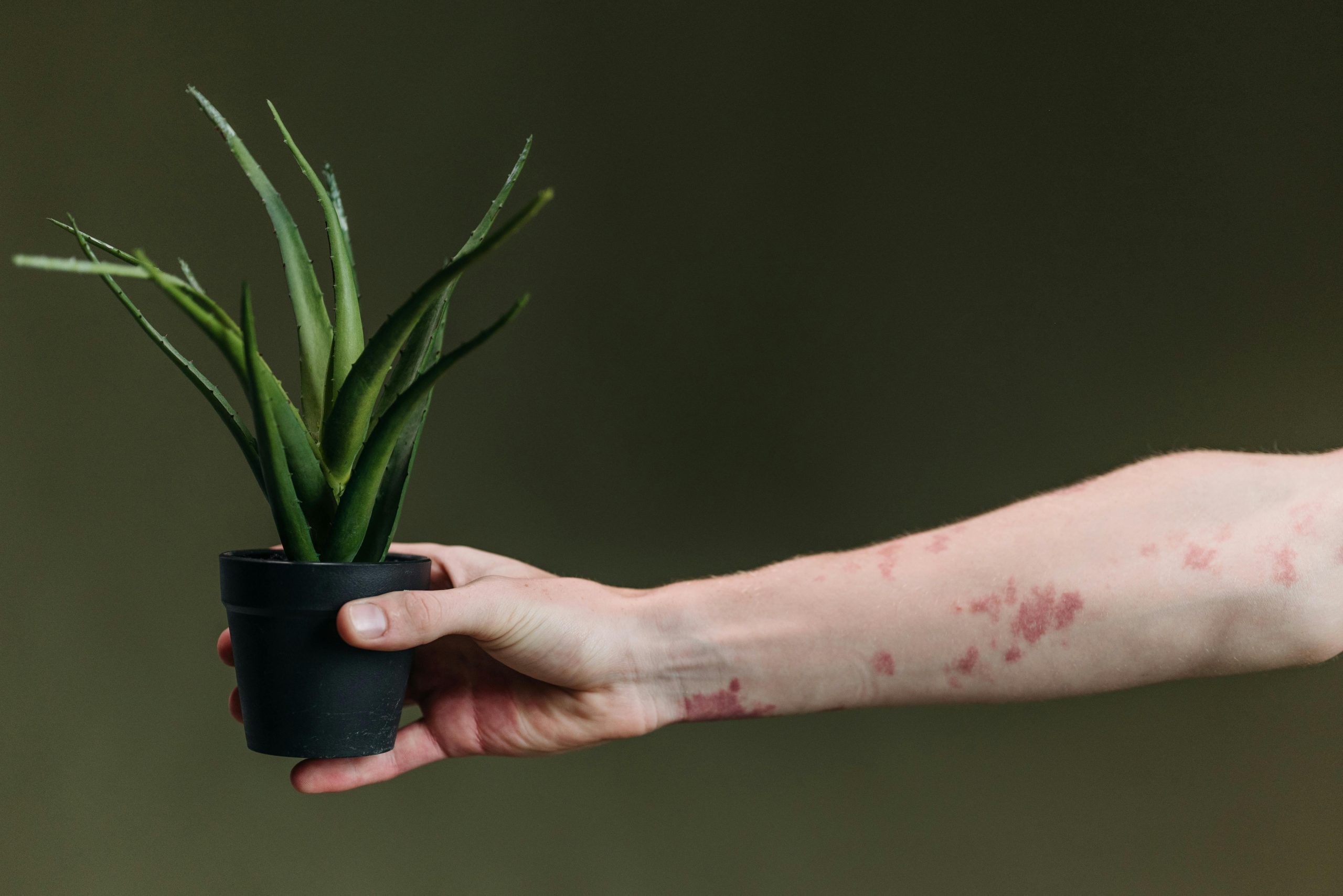 An arm that has eczema holding a potted plant